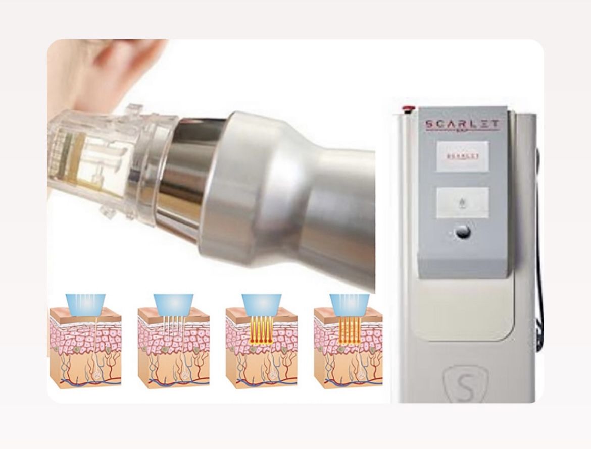 RF فرکشنال در اهواز