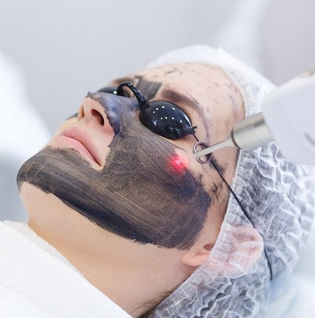 ماسک کربن لیزر در اهواز